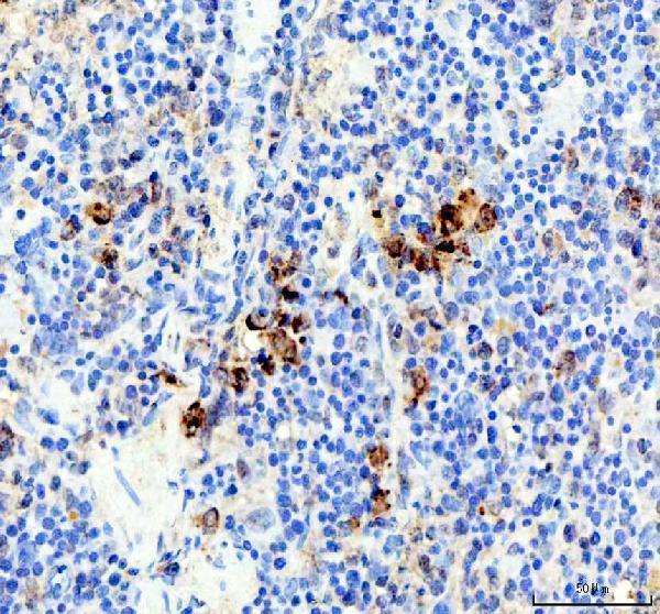 pb10058 ela2 primary antibodies ihc testing 3