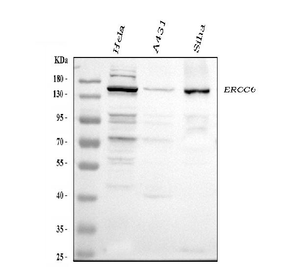 Western blot analysis of CSB using anti-CSB antibody (PB10060).