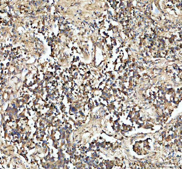pb10068 gpi primary antibodies ihc testing 1