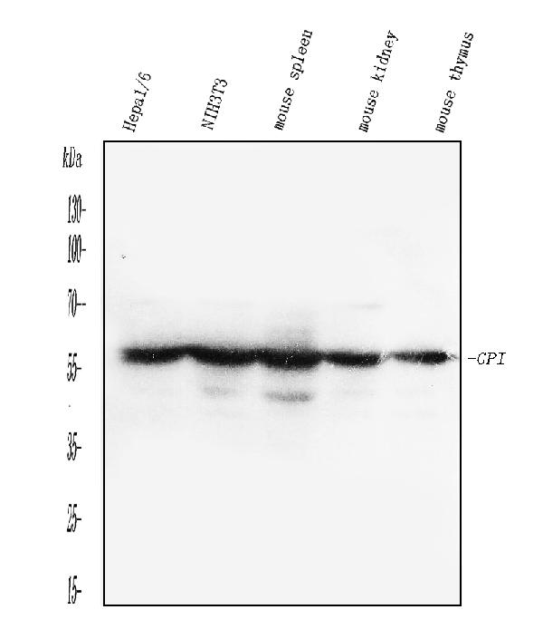 Figure 1. Western blot analysis of GPI using anti-GPI antibody (PB10069). Electrophoresis was performed on a 5-20% SDS-PAGE gel at 70V (Stacking gel) / 90V (Resolving gel) for 2-3 hours. The sample well of each lane was loaded with 30 ug of sample under reducing conditions. Lane 1: mouse HEPA1-6 whole cell lysates, Lane 2: mouse NIH/3T3 whole cell lysates, Lane 3: mouse spleen tissue lysates, Lane 4: mouse kidney tissue lysates, Lane 5: mouse thymus tissue lysates. After electrophoresis, proteins were transferred to a nitrocellulose membrane at 150 mA for 50-90 minutes. Blocked the membrane with 5% non-fat milk/TBS for 1.5 hour at RT. The membrane was incubated with rabbit anti-GPI antigen affinity purified polyclonal antibody (Catalog # PB10069) at 0.5 microg/mL overnight at 4°C, then washed with TBS-0.1%Tween 3 times with 5 minutes each and probed with a goat anti-rabbit IgG-HRP secondary antibody at a dilution of 1:5000 for 1.5 hour at RT. The signal is developed using an Enhanced Chemiluminescent detection (ECL) kit (Catalog # EK1002) with Tanon 5200 system. A specific band was detected for GPI at approximately 64 kDa. The expected band size for GPI is at 63 kDa.