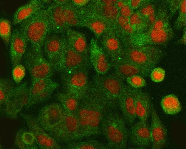 Figure 2. IF analysis of HLTF using anti-HLTF antibody (PB10070) and anti-Tubulin Alpha antibody (M03989-3). HLTF was detected in immunocytochemical section of A549 cell. Enzyme antigen retrieval was performed using IHC enzyme antigen retrieval reagent (AR0022) for 15 mins. The cells were blocked with 10% goat serum. And then incubated with 5 microg/mL rabbit anti-HLTF Antibody (PB10070) and mouse anti-Tubulin Alpha antibody (M03989-3) overnight at 4°C. Cy3 Conjugated Goat Anti-Rabbit IgG (BA1032) and DyLight®488 Conjugated Goat Anti-Mouse IgG (BA1126) were used as secondary antibody at 1:500 dilution and incubated for 30 minutes at 37°C. Visualize using a fluorescence microscope and filter sets appropriate for the label used.