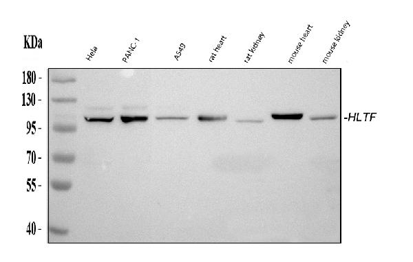 Figure 1. Western blot analysis of HLTF using anti-HLTF antibody (PB10070). Electrophoresis was performed on a 5-20% SDS-PAGE gel at 70V (Stacking gel) / 90V (Resolving gel) for 2-3 hours. The sample well of each lane was loaded with 30 ug of sample under reducing conditions. Lane 1: human Hela whole cell lysates, Lane 2: human PANC-1 whole cell lysates, Lane 3: human A549 whole cell lysates, Lane 4: rat heart tissue lysates, Lane 5: rat kidney tissue lysates, Lane 6: mouse heart tissue lysates, Lane 7: mouse kidney tissue lysates. After electrophoresis, proteins were transferred to a nitrocellulose membrane at 150 mA for 50-90 minutes. Blocked the membrane with 5% non-fat milk/TBS for 1.5 hour at RT. The membrane was incubated with rabbit anti-HLTF antigen affinity purified polyclonal antibody (Catalog # PB10070) at 0.5 microg/mL overnight at 4°C, then washed with TBS-0.1%Tween 3 times with 5 minutes each and probed with a goat anti-rabbit IgG-HRP secondary antibody at a dilution of 1:5000 for 1.5 hour at RT. The signal is developed using an Enhanced Chemiluminescent detection (ECL) kit (Catalog # EK1002) with Tanon 5200 system. A specific band was detected for HLTF at approximately 114 kDa. The expected band size for HLTF is at 114 kDa.