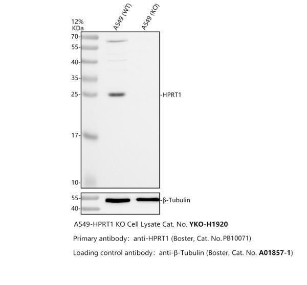 Western blot analysis of HPRT1 using anti-HPRT1 antibody (PB10071)