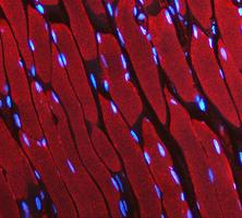 pb10075 ldha primary antibodies if testing 13_1_1