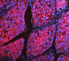 pb10075 ldha primary antibodies if testing 14_2