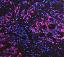 pb10075 ldha primary antibodies if testing 16