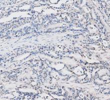 pb10075 ldha primary antibodies ihc testing 10