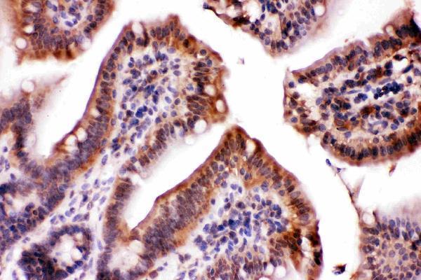 pb10075 ldha primary antibodies ihc testing 3