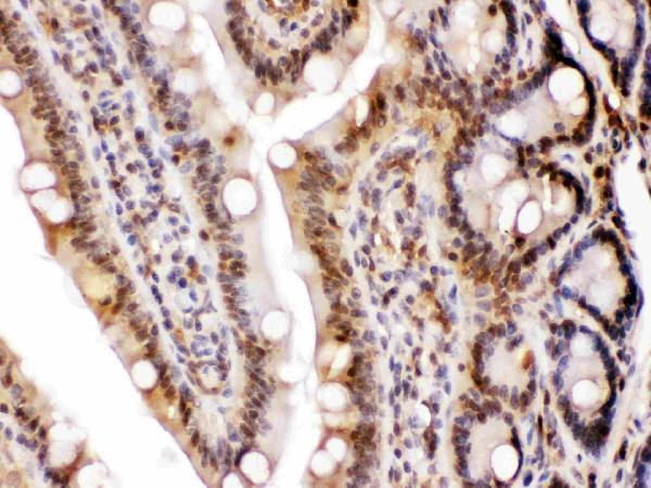 pb10075 ldha primary antibodies ihc testing 4