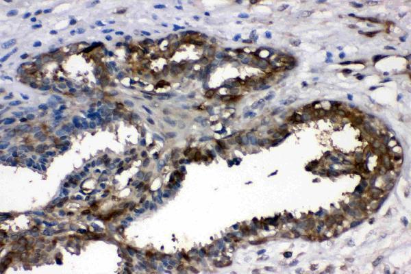 pb10075 ldha primary antibodies ihc testing 5