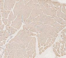 pb10075 ldha primary antibodies ihc testing 6_1_1