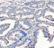 pb10075 ldha primary antibodies ihc testing 8_1_1