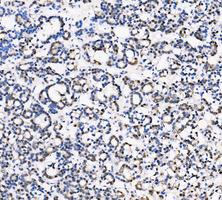 pb10075 ldha primary antibodies ihc testing 9_1_1
