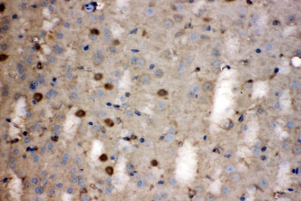  IHC analysis of LDHB using anti-LDHB antibody (PB10076)
