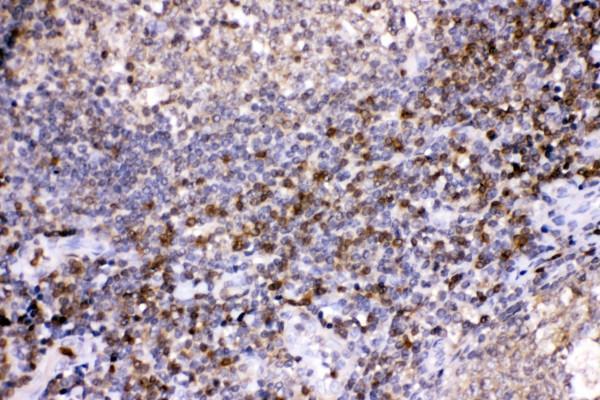 pb10076 4 ihc anti ldhb lactate dehydrogenase b picoband antibody