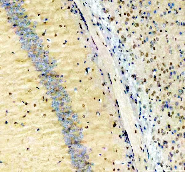 IHC analysis of NFIA using anti-NFIA antibody (PB10080)