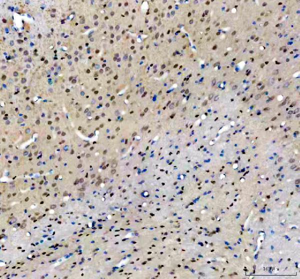 IHC analysis of NFIA using anti-NFIA antibody (PB10080)