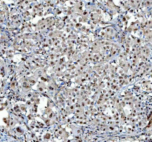 pb10087 psma1 primary antibodies ihc testing 2