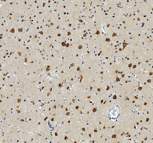 pb10092 rpl19 primary antibodies ihc testing 1