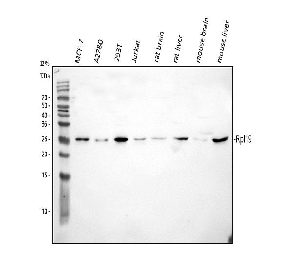 Figure 1. Western blot analysis of RPL19 using anti-RPL19 antibody (PB10092). Electrophoresis was performed on a 5-20% SDS-PAGE gel at 70V (Stacking gel) / 90V (Resolving gel) for 2-3 hours. The sample well of each lane was loaded with 30 ug of sample under reducing conditions. Lane 1: human MCF-7 whole cell lysates, Lane 2: human A2780 whole cell lysates, Lane 3: human 293T whole cell lysates, Lane 4: human Jurkat whole cell lysates, Lane 5: rat brain tissue lysates, Lane 6: rat liver tissue lysates, Lane 7: mouse brain tissue lysates, Lane 6: mouse liver tissue lysates. After electrophoresis, proteins were transferred to a nitrocellulose membrane at 150 mA for 50-90 minutes. Blocked the membrane with 5% non-fat milk/TBS for 1.5 hour at RT. The membrane was incubated with rabbit anti-RPL19 antigen affinity purified polyclonal antibody (Catalog # PB10092) at 0.5 microg/mL overnight at 4°C, then washed with TBS-0.1%Tween 3 times with 5 minutes each and probed with a goat anti-rabbit IgG-HRP secondary antibody at a dilution of 1:5000 for 1.5 hour at RT. The signal is developed using an Enhanced Chemiluminescent detection (ECL) kit (Catalog # EK1002) with Tanon 5200 system. A specific band was detected for RPL19 at approximately 26 kDa. The expected band size for RPL19 is at 23 kDa.
