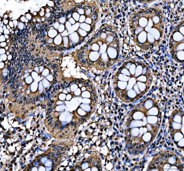 pb10095 safb primary antibodies ihc testing 1