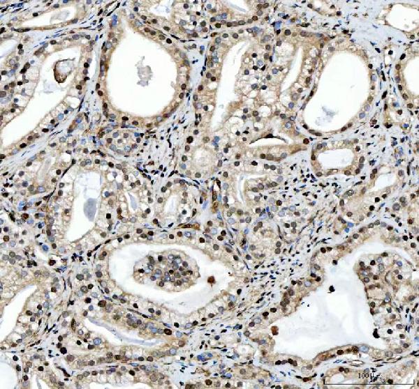 pb10095 safb primary antibodies ihc testing 3
