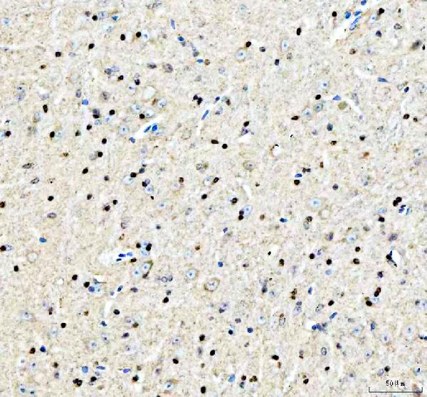 pb10095 safb primary antibodies ihc testing 4
