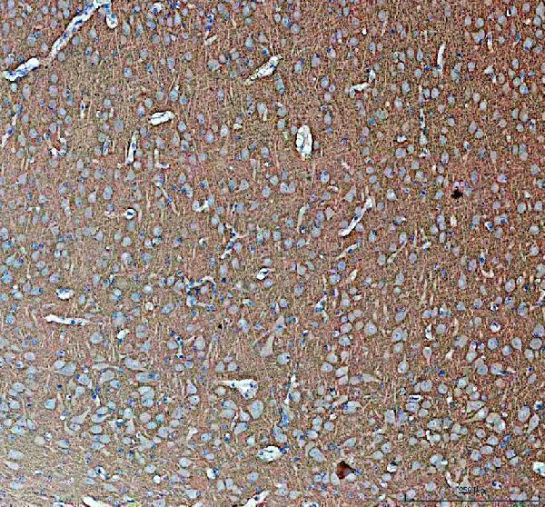 pb10100 syn2 primary antibodies ihc testing 1