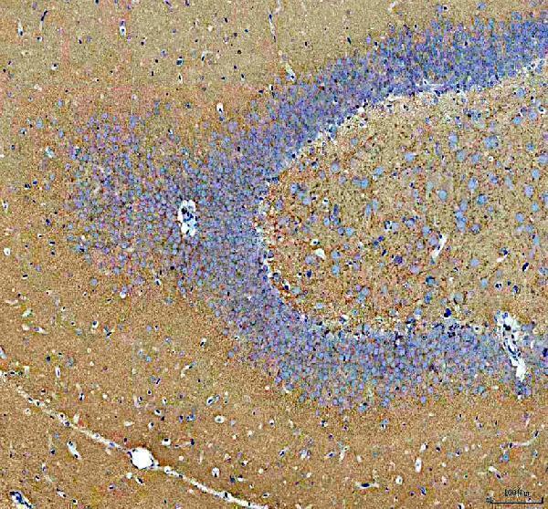 pb10100 syn2 primary antibodies ihc testing 3