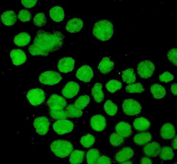 pb9008 p53 primary antibodies if testing 3