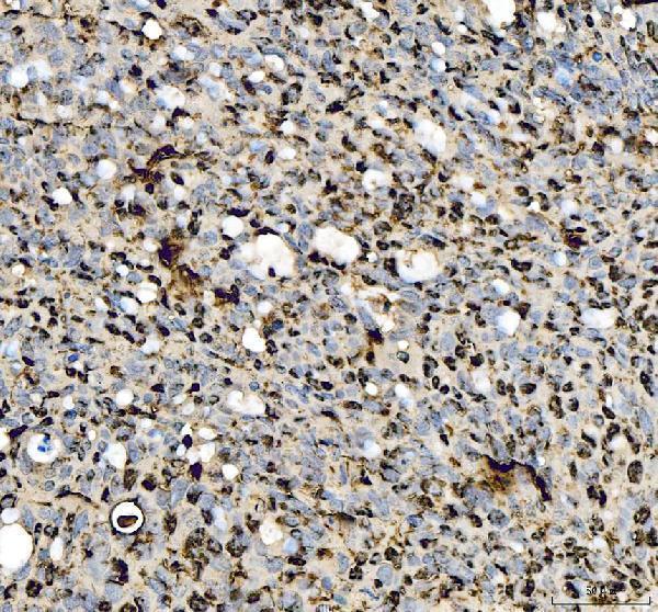 pb9008 p53 primary antibodies ihc testing 2_1