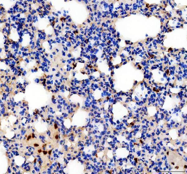 IHC analysis of IL18 using anti-IL18 antibody (PB9014)