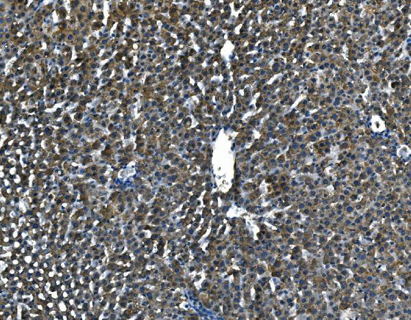 Figure 2. IHC analysis of Serum Amyloid P using anti-Serum Amyloid P antibody (PB9020). Serum Amyloid P was detected in a paraffin-embedded section of rat liver tissue. Heat mediated antigen retrieval was performed in EDTA buffer (pH 8.0, epitope retrieval solution). The tissue section was blocked with 10% goat serum. The tissue section was then incubated with 2 microg/ml rabbit anti-Serum Amyloid P Antibody (PB9020) overnight at 4°C. Peroxidase Conjugated Goat Anti-rabbit IgG was used as secondary antibody and incubated for 30 minutes at 37°C. The tissue section was developed using HRP Conjugated Rabbit IgG Super Vision Assay Kit (Catalog # SV0002) with DAB as the chromogen.