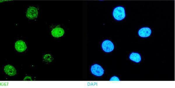 pb9026 ki67 primary antibodies icc testing 1