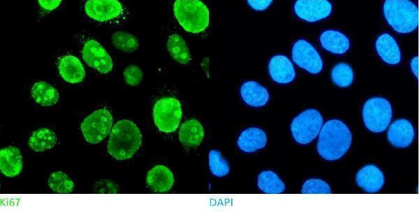 pb9026 ki67 primary antibodies icc testing 2