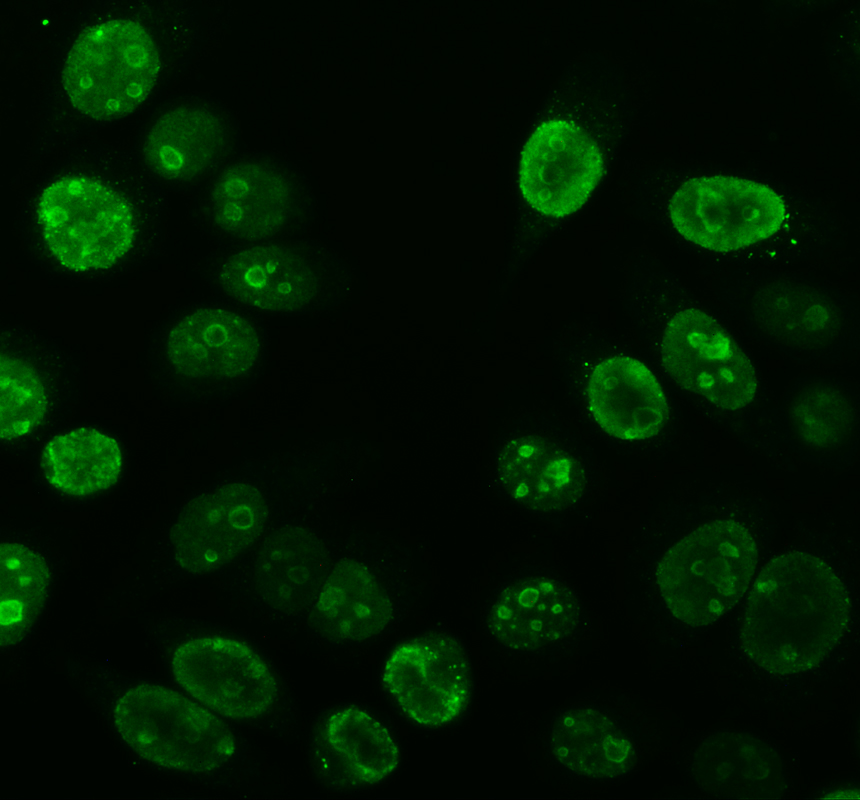 pb9026 ki67 primary antibodies if testing 1