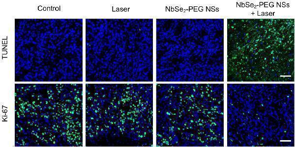 pb9026 ki67 primary antibodies if testing 4