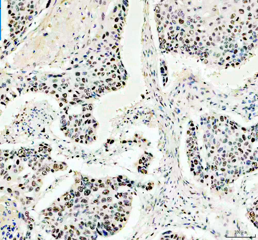 pb9026 ki67 primary antibodies ihc testing 1