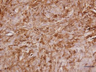pb9026 ki67 primary antibodies ihc testing 1