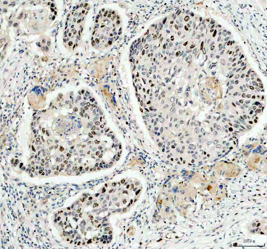 pb9026 ki67 primary antibodies ihc testing 2