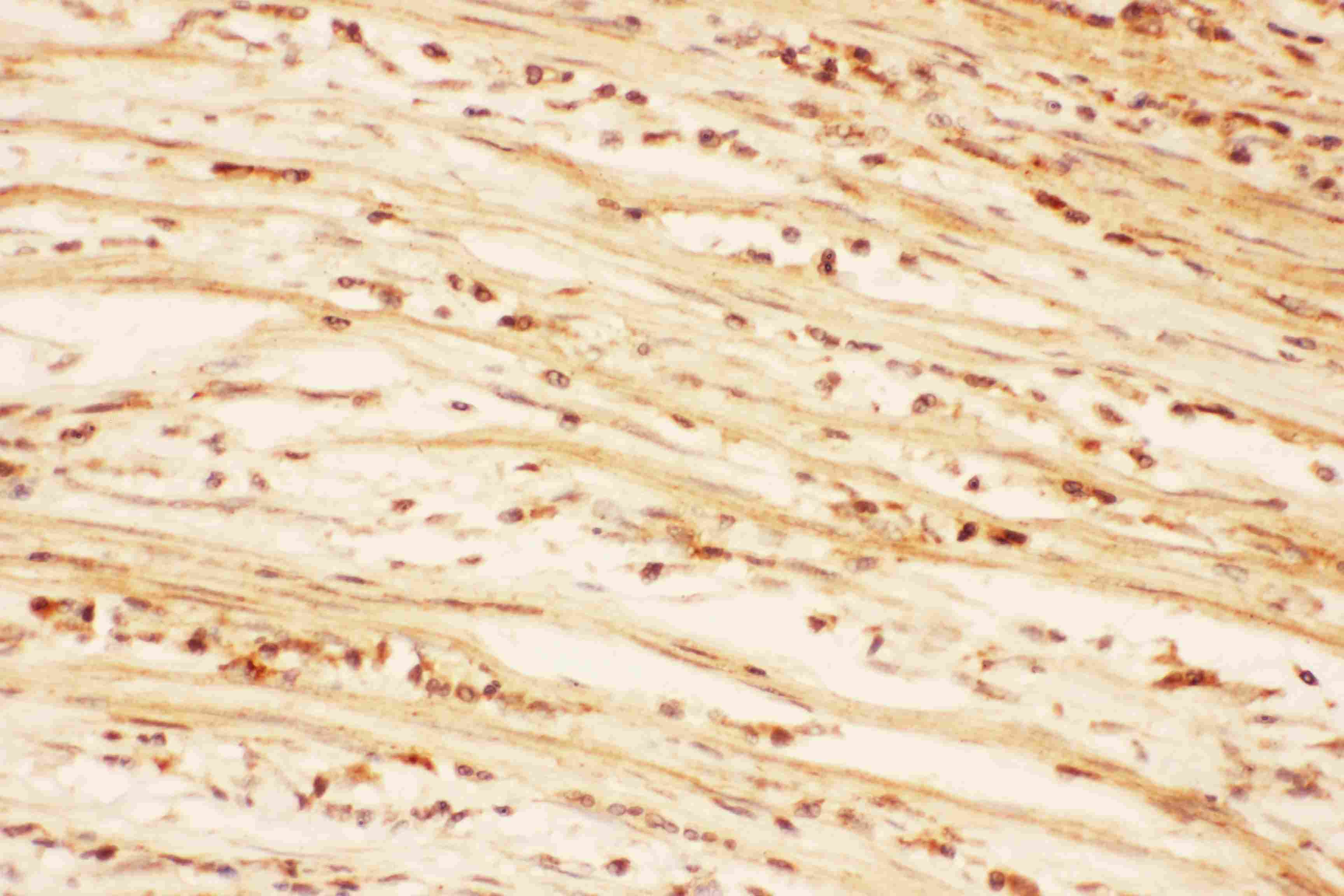 Anti-AKT2 Picoband™ Antibody PB9043