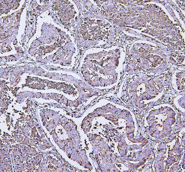  IHC analysis of Annexin V/ANXA5 using anti-Annexin V/ANXA5 antibody (PB9044)