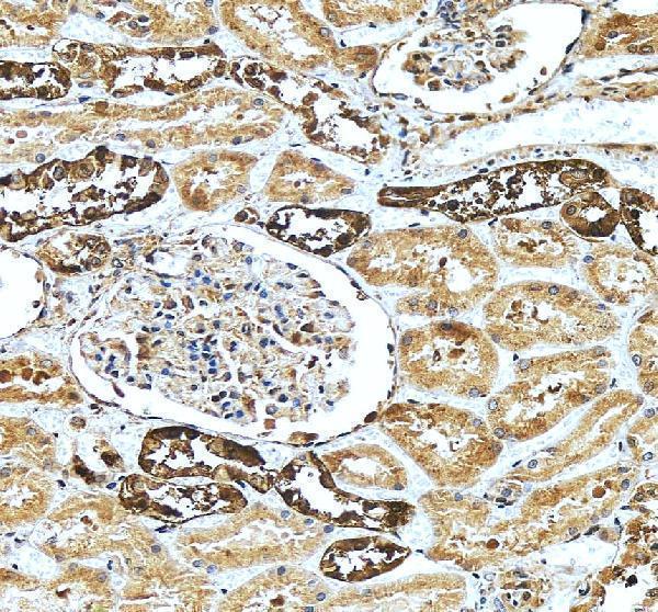 pb9045 calb1 primary antibodies ihc testing 4