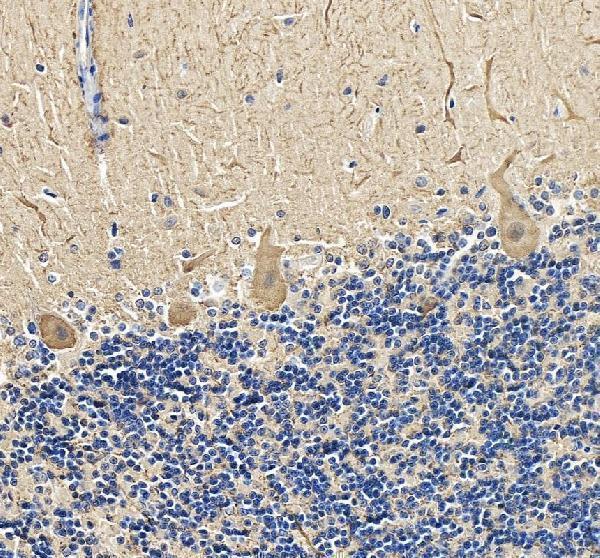 pb9045 calb1 primary antibodies ihc testing 5