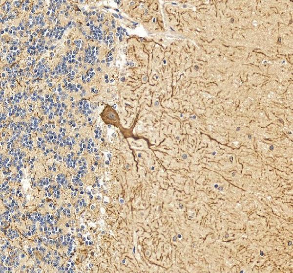 pb9045 calb1 primary antibodies ihc testing 6