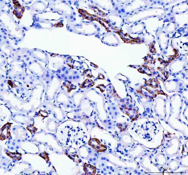 pb9045 calbindin primary antibodies ihc testing 2
