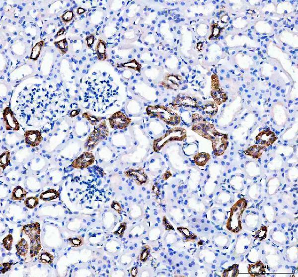 pb9045 calbindin primary antibodies ihc testing 3