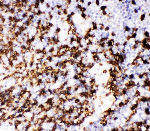 pb9050 3 ihc anti cd20 picoband antibody