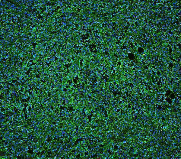 pb9050 cd20 primary antibodies if testing 4