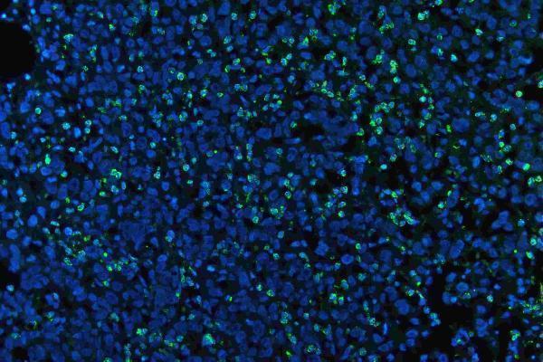 pb9057 mpo primary antibodies if testing 10